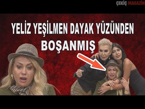 YELİZ YEŞİLMEN’ İN BOŞANMA SEBEBİ ŞİDDET Mİ?